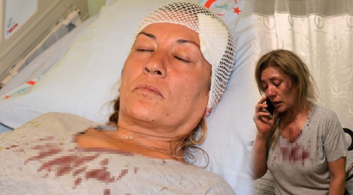 Hayvansever Kadını Komşusu Yaraladı !